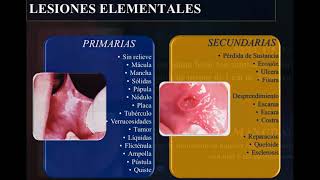 CLASE LESIONES ELEMENTALES OCT 20 [upl. by Eitsym57]