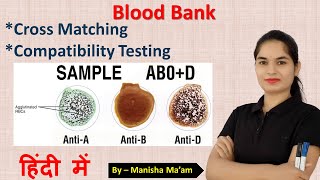 Cross Match Test in blood bank  Technique of cross matching  cross matching blood procedure [upl. by Haidabej]