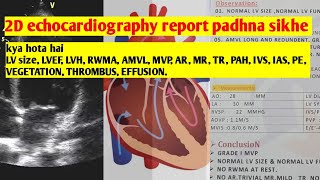 2D echocardiography ki report padhna sikhe [upl. by Godfry]