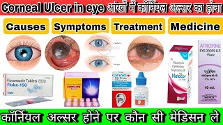 Corneal Ulcerकॉर्नियल अल्सरFull treatment in hindi perfectionpharmacyeye eyetreatment [upl. by Hanschen]