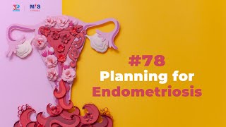 Planning for Endometriosis Surgery [upl. by Osrock5]