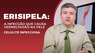 Erisipela A infecção que causa vermelhidão na pele Celulite infecciosa [upl. by Rozele592]