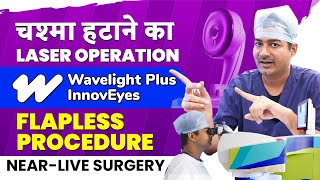 AIBased Flapless Laser Specs Removal Procedure with Wavelight Plus InnovEyes [upl. by Euqinoj809]