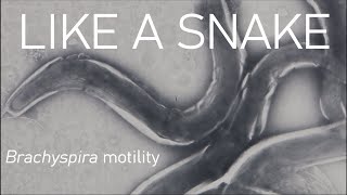 Snake like motion on a tiny scale  Brachyspira [upl. by Nikos]