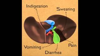 Sludge in Gallbladder Symptoms [upl. by Safire161]