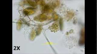 Pediastrum duplex  autocolony formation [upl. by Leisha]