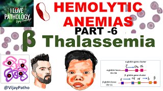 Hemolytic Anemias Part 6 Beta Thalassemia Pathogenesis types Diagnosis amp Treatment [upl. by Ahselrac296]