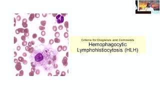 Hemophagocytic Lymphohistiocytosis HLH – Dr Maher Aljhohani September 1516 2023 [upl. by Eiramyllek]