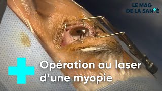 Corriger la myopie grâce à la chirurgie laser  Le Magazine de la Santé [upl. by Ailuj928]