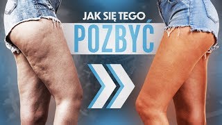 Jak POZBYĆ SIĘ Cellulitu szybko i skutecznie [upl. by Chu]