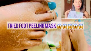 Finally tried foot peeling mask amp See Here is the result 🥹🥹Shivanibful [upl. by Ynnol925]