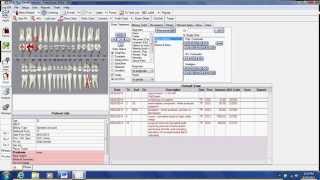 EZ 2000 Plus Dental Software  Treatment Planning [upl. by Combe]