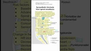 Sympathetic blockade from spinal anesthesia [upl. by Fernald]