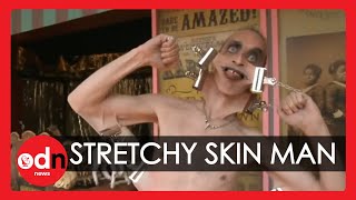 Meet the man with the worlds stretchiest skin  WEIRD [upl. by Briano]