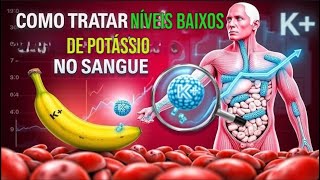 Como Tratar Níveis Baixos de Potássio no Sangue [upl. by Nosyarg]