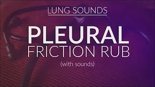 Pleural Friction Rub  Pleural Rub [upl. by Anayet495]