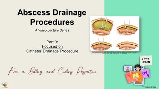 Episode 15 Abscess Drainage Lecture Series  Part 3 of 4 Catheter Drainage Procedure [upl. by Anenahs]