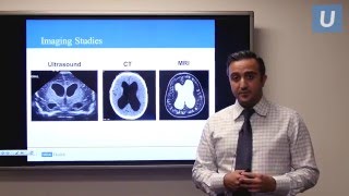 Management of Pediatric Hydrocephalus  Aria Fallah MD  UCLAMDChat [upl. by Savart]