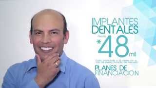 Implantes dentales desde 48000 mensuales [upl. by Pascha304]