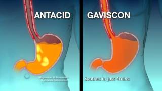 Gaviscon Livewell TVC [upl. by Llerehc]