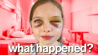 MY DAUGHTERS ACCIDENT [upl. by Cirle400]