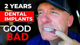 The GOOD and BAD Of My Dental Implants After 2 Years [upl. by Slaby751]