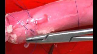 Aortic Cannulation and Decannulation  Cardiac Surgical Skills Laboratory [upl. by Kcirdorb]