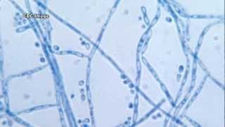 Cladosporium and IAQ [upl. by Adena469]