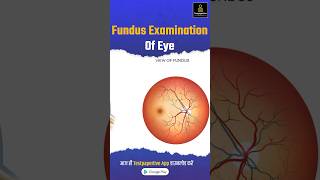 Funds Examination of eye explained simply in less than 60seconds funds examination ophthalmology [upl. by Rabelais]