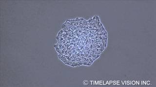 Growth of Hemophilus influenzae インフルエンザ菌の増殖 [upl. by Robma]