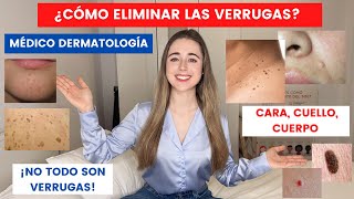 MÉDICO EXPLICA CÓMO ELIMINAR VERRUGAS EN CARA CUELLO Y CUERPO ¿EN CASA  LO QUE NO SON VERRUGAS [upl. by Oilisab]