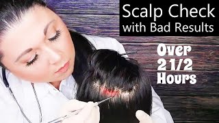 ASMR Scalp Check with Bad Results Compilation Scalp Treatment Whispering Medical Roleplay [upl. by Enyrat986]