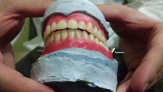 Enfilado de dientes artificiales en prótesis total 22 [upl. by Cartan]