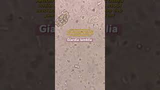 Giardia lamblia under the microscope laboratory microscope mls cls medtechstudent [upl. by Sunshine325]