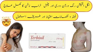 Terbisil tablet uses in urdu  terbisil tablet 125mg  terbisil tablet 250mg how to use terbinafine [upl. by Wixted]