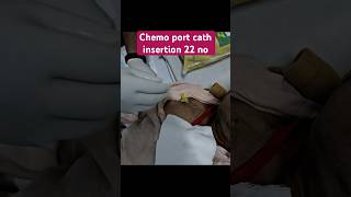 Chemo port cath insertion 22 no [upl. by Trefor642]