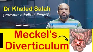 Meckels diverticulum medical students and pediatric surgeons [upl. by Ahsem139]