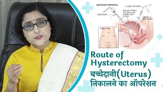 बच्चेदानी निकलने के लिए कौन सा आपरेशन कराएं  दूरबीन या फिर हाथ वाला routes of hysterectomy [upl. by Welbie365]