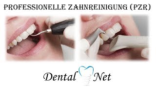 Professionelle zahnreinigung PZR [upl. by Whipple]