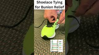 Shoelace Tying for Bunion Relief [upl. by Barbi]