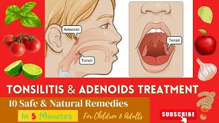 10 Best Effective Proven Home Remedies For Enlarge  Swelling ADENOIDS and TONSILS In Children [upl. by Janina]