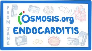 Clinicians Corner Endocarditis [upl. by Astri]