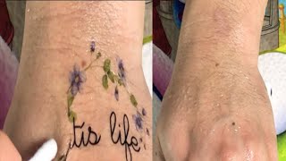 HOW TO REMOVE TATTOOS AT HOME  My experience was more gentle   Charming tattoo asmr 62 [upl. by Aremaj]