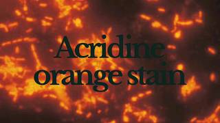 Acridine Orange Staining  Principle Method and Result [upl. by Ivana]