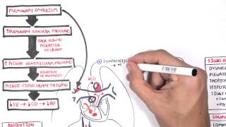 Pulmonary Embolism PART I Overview [upl. by Marmaduke]