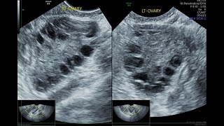 Short Ultrasound Spotters  Quiz  3 [upl. by Wehttam]