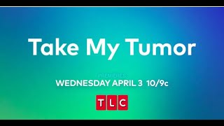 TLC TAKE MY TUMOR Trailer [upl. by Tihom527]