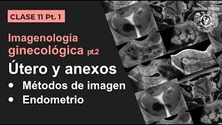 111  Imagen Ginecológica Métodos de estudio y patología endometrial [upl. by Annabela]