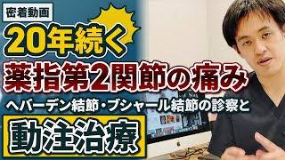 診察風景 密着動画 20年以上続く指の痛み（くすり指第2関節）へバーデン結節・ブシャール結節の診察風景と動注治療 [upl. by Sudbury376]