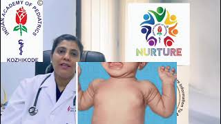 Gynaecomastia  ആൺകുട്ടികളിലെ സ്തന വളർച്ച അറിയേണ്ടതെല്ലാം [upl. by Oilut]